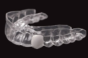 Dating a guy with false teeth-in-Turakina