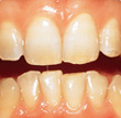 Need professional teeth whitening? We can help!